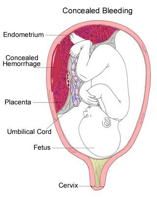 Glycomet and pregnancy mg during